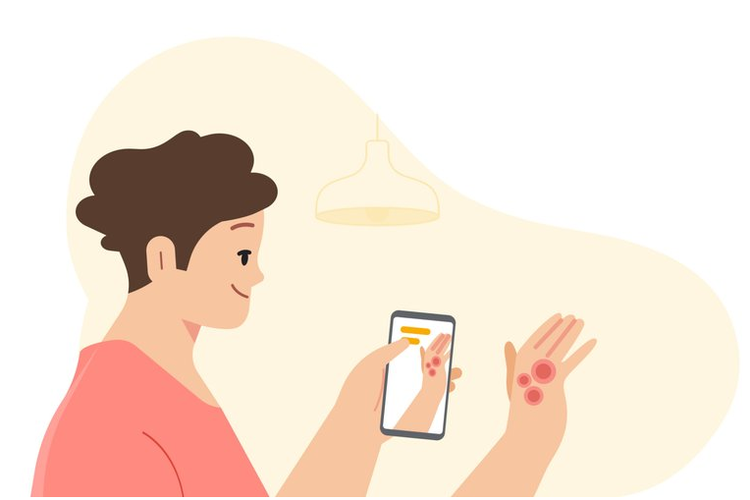 Dermatology Assist, alat berbasis AI buatan Google untuk membantu mendeteksi kondisi kulit.