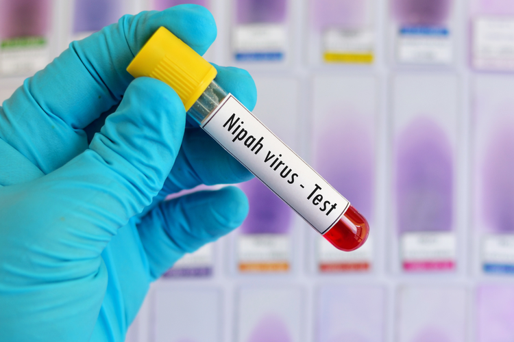 Ilustrasi virus Nipah. WHO melaporkan dua tenaga kesehatan muda terinfeksi virus nipah di Bengala Barat dengan sumber penularan yang masih ditelusuri.