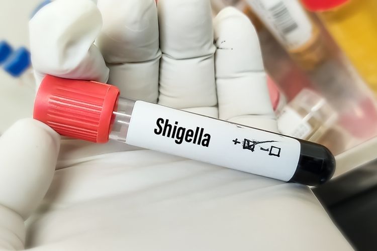 Ilustrasi tes untuk melihat infeksi Shigella