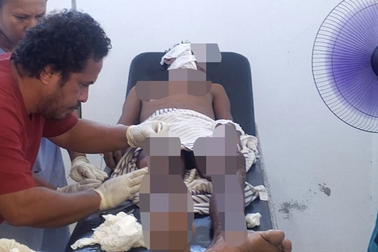 ABK Terluka Saat Speedboat yang Akan Jemput Bupati Tanimbar Terbakar Dirawat di Puskesmas