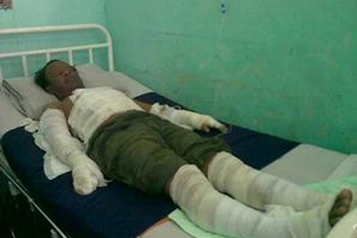 Kasran (40) tergolek lemah di RS Sumber Waras, Jakarta, Minggu (25/7/2010), akibat luka bakar yang dideritanya. Tabung gas 3 kg yang hendak digunakannya bocor dan api menyambar tubuhnya. Kasran belum bisa dimintai keterangan karena masih lemah.