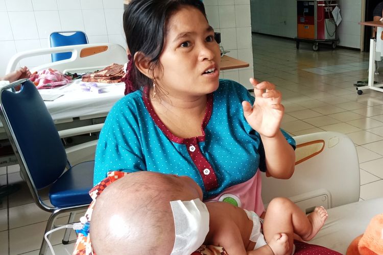 Afsana menggendong anaknya Afdun Hamdan yang menderita hidrosefalus sejak lahir ruang Rindu A RSUPHAM Medan, Jumat (8/3/2019)