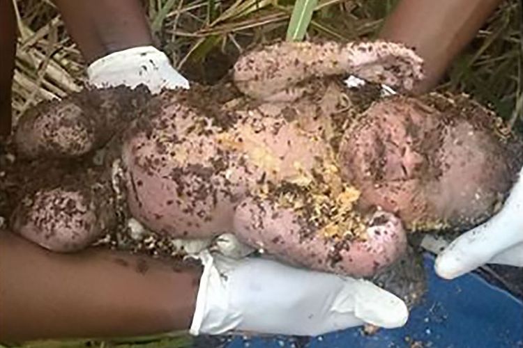 Inilah kondisi bayi yang sudah dikubur selama tiga hari sebelum ditemukan para pekerja sebuah perusahaan kayu di Afrika Selatan.