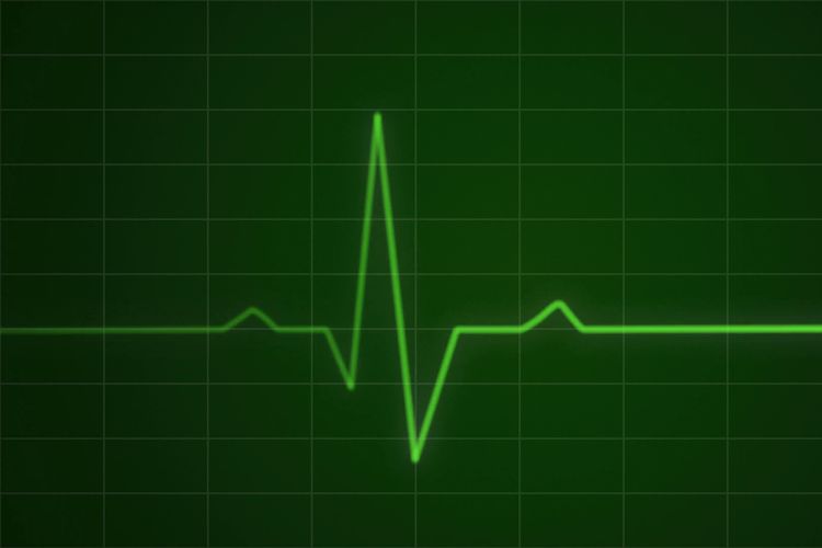 Sinyal pada cardiogram mendeteksi denyut jantung merupakan salah satu fenomena gelombang.