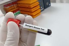 Buerger Disease