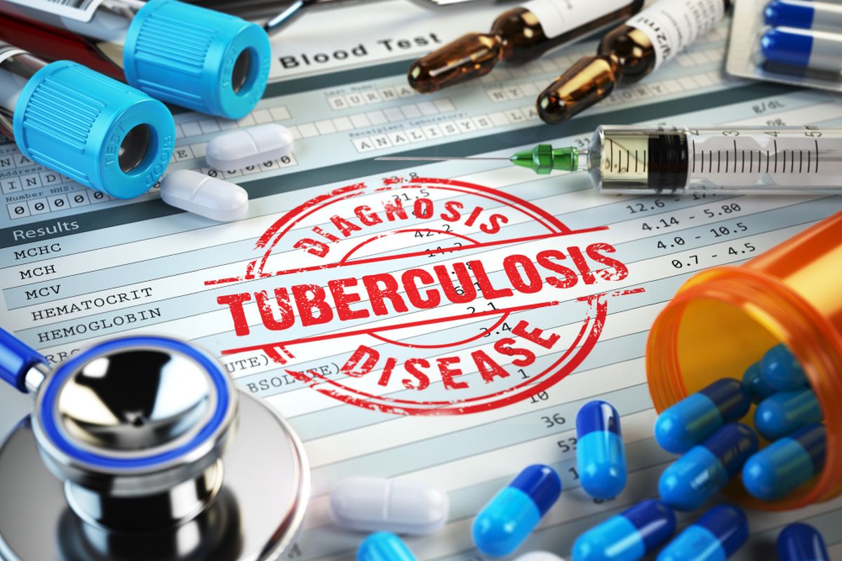 Ilustrasi tuberculosis (TBC)