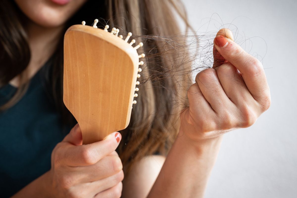 Ilustrasi rambut rontok. Rambut rontok kurang vitamin apa?