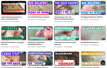 Tangkapan layar konten video pencet jerawat yang ditonton jutaan orang. Apa alasan orang suka nonton video pencet jerawat?