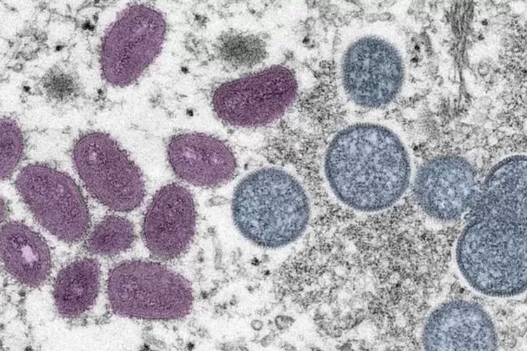 Gambar virus cacar monyet dilihat dari mikroskop.