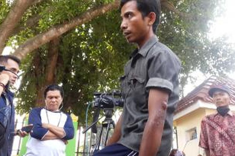 Rahmat Ahmad (28), tukang bangunan yang selamat saat Pesawat Hercules C-130 jatuh di Jalan Jamin Ginting, Medan, Sumatera Utara