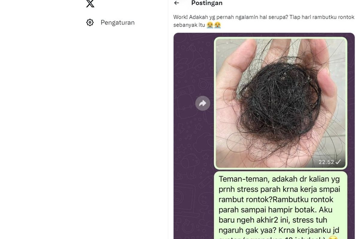 Benarkah stres dapat menyebabkan rambut rontok dan memicu kebotakan.