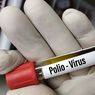 Dokter Ingatkan Polio Tanpa Gejala Lumpuh Tetap Perlu Diwaspadai