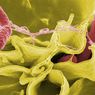 Apa itu Salmonella dan Bagaimana Cara Mencegah Infeksinya?