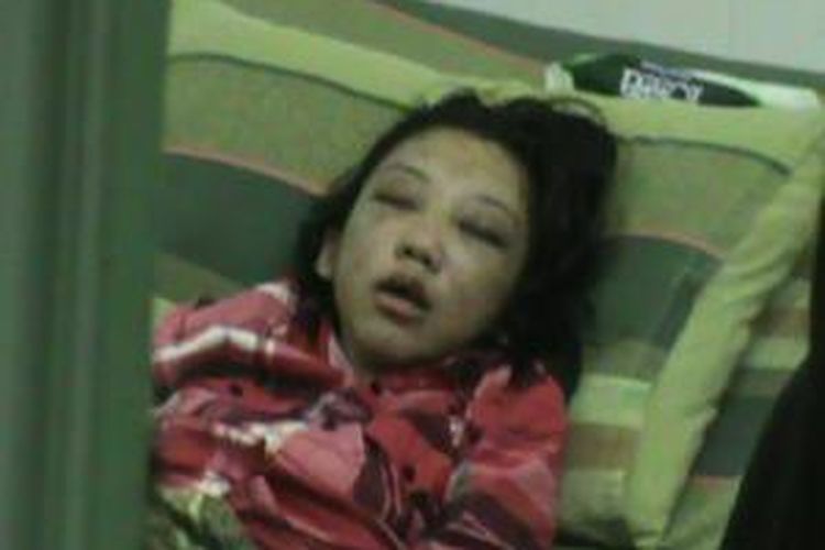 Erwiana terbaring di rumah sakit Amal Sehat, Sragen, Senin (20/1/2014). 