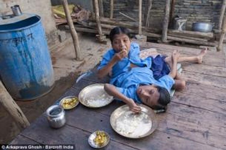 Beginilah cara kembar siam Shivram dan Shivnath (12) makan. Pasangan kembar siam ini melakukan semua kegiatan hariannya sendiri dan mereka menegaskan tak ingin dipisahkan.