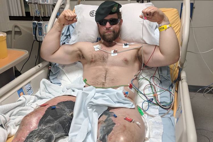 Justin Lascek, Sersan Medis Pasukan Khusus Baret Hijau di Angkatan Darat AS, kehilangan buah zakar dan kedua kakinya akibat ledakan bom saat bertugas di Afghanistan pada 2018.