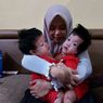 Bayi Kembar Siam di Bandung Barat Bakal Jalani Operasi Pemisahan Tubuh Bulan Depan