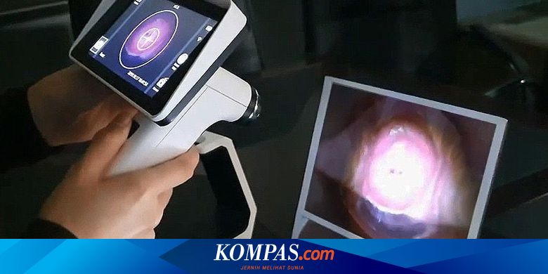 Alat Deteksi Dini Kanker Serviks Non Invansif Segera Diluncurkan