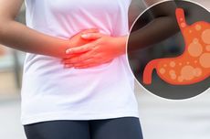 Apakah Sakit Maag Sama Dengan GERD? Ini Penjelasan Dokter…