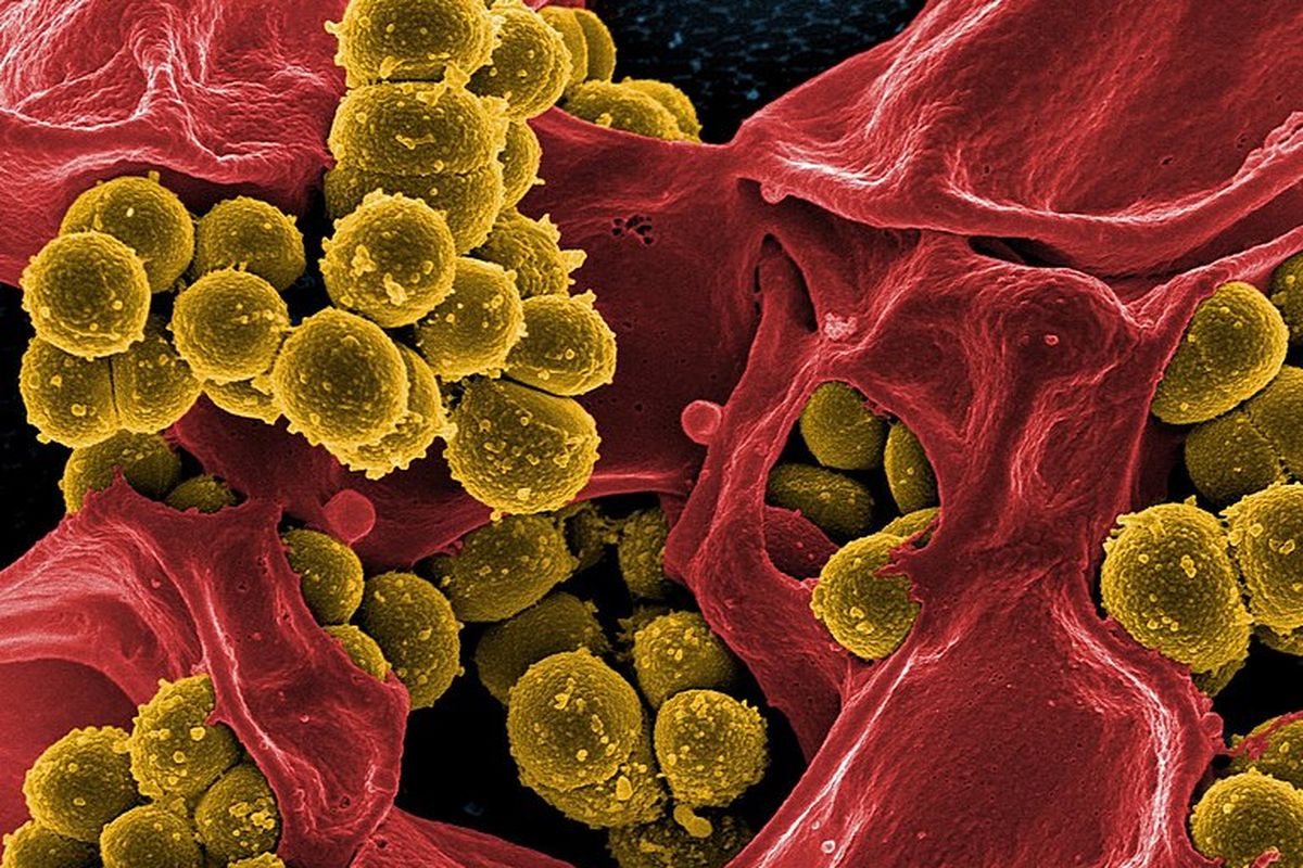 Hasil pemindaian mikrograf elektron dari bakteri Staphylococcus aureus yang resisten atau kebal antibiotik jenis methicillin (kuning) dan sel darah putih manusia yang mati (berwarna merah).