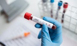 Uji Coba Kandidat Vaksin HIV Baru Tunjukkan Hasil Awal yang Positif