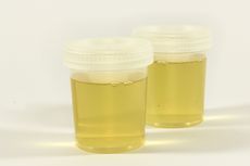 Apa Efek Samping Minum Urine terhadap Kesehatan? Ini Ulasannya..