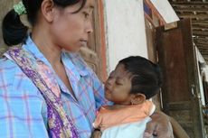 Derita Komplikasi Penyakit, Anak Balita di Sukoharjo Butuh Bantuan