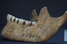 “Pasien Nol” Wabah Black Death Ditemukan dari Jasad Berusia 5.000 Tahun