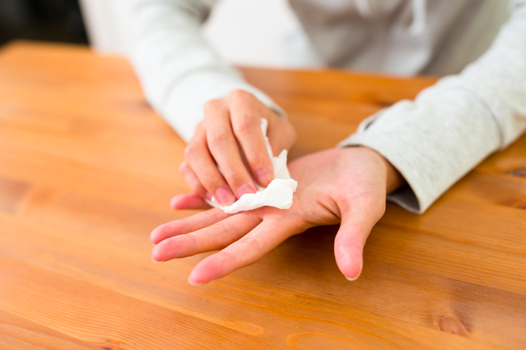 Hiperhidrosis primer adalah alasan mengapa telapak tangan sering berkeringat.