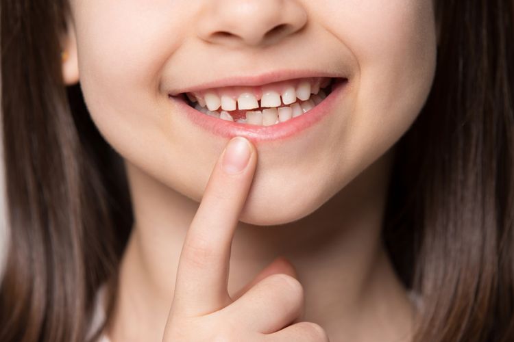 3 Alasan Kenapa Jumlah Gigi Dewasa dan Anak-anak Berbeda