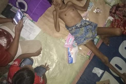 Bocah 13 Tahun di Depok Meninggal Dunia Disebabkan Gizi Buruk