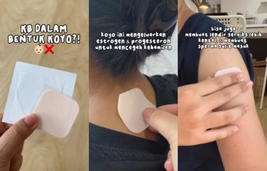Tangkap layar penggunaan alat kontrasepsi berbentuk koyo.