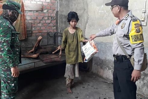 Kisah Pilu Kakak Beradik Kelaparan, Yatim Piatu, Kurus Kering dan Wajahnya Pucat