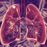 3 Penyebab Paru-paru Basah yang Utama