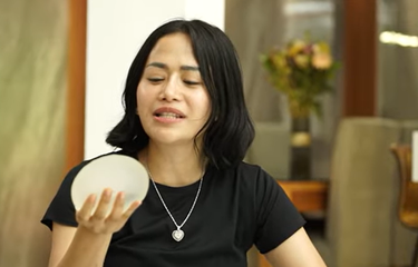 Farida Nurhan atau Omay tunjukkan implan payudara 