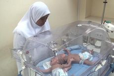 Bayi Kembar Siam Dempet Kepala Dirujuk ke Yogyakarta