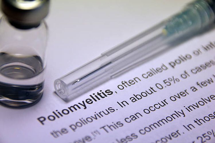 Gejala Poliomielitis Abortif, Kondisi Penyakit Polio Paling Ringan
