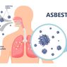 Asbestosis