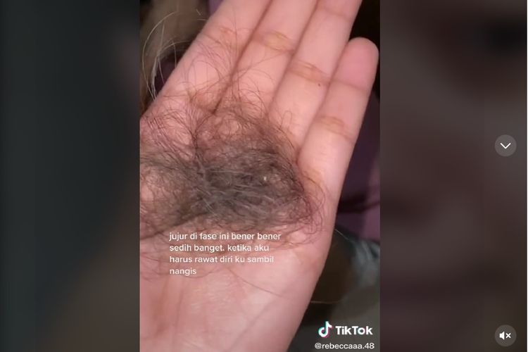 tangkap layar rambut rontok pasien Omicron