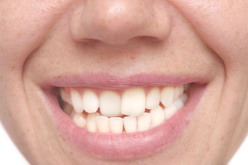 7 Fakta Menarik tentang Gigi Manusia