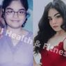 Tanpa Diet Ekstrem Turun Bobot 30 Kg dalam Setahun, Kok Bisa?
