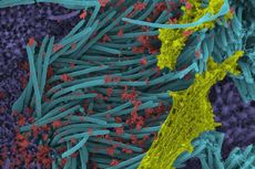 Studi Temukan Hubungan Virus Corona SARS-CoV-2 dan Sel Paru-paru Manusia