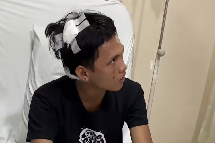 Fatur, Pelajar 18 Tahun Korban Kerusuhan Pejompongan, Dapat 12 Jahitan dan Sundutan Rokok