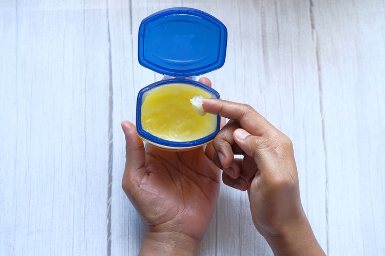 Petroleum jelly juga bisa menjadi salah satu cara menghilangkan kutu rambut dengan membunuhnya dan mungkin juga telur-telurnya.