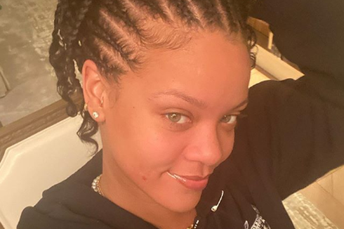 Foto Selfie dengan Wajah Berjerawat? Jangan Ragu, Contohlah Rihanna