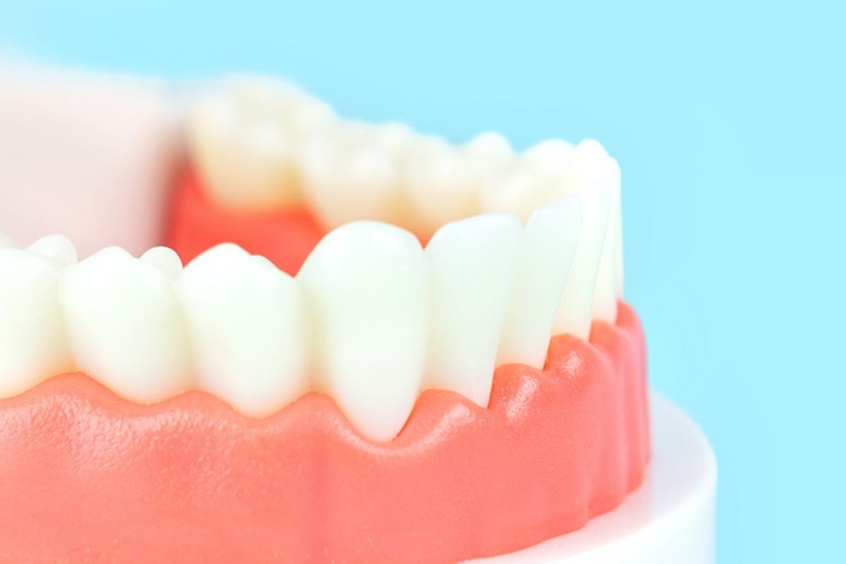 Ilustrasi gigi palsu. Cara klaim gigi palsu BPJS Kesehatan. Syarat dan cara klaim gigi palsu BPJS Kesehatan.