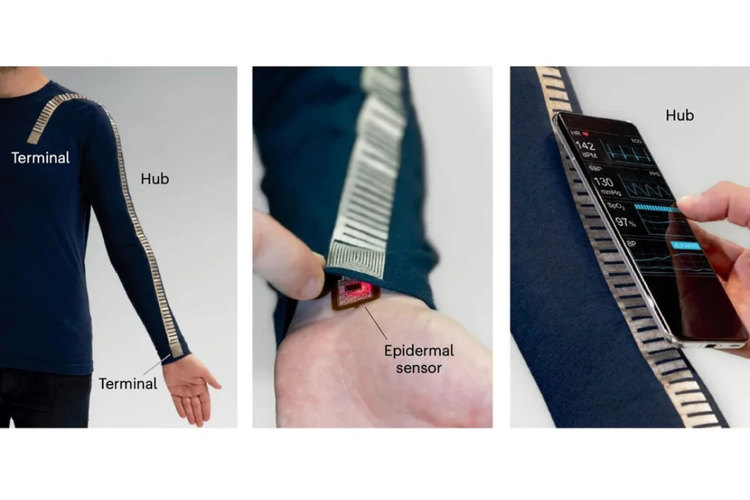 Sistem tekstil pintar menghubungkan sensor melalui kain khusus dan memanfaatkan smartphone sebagai sumber daya serta pusat pengolahan data.