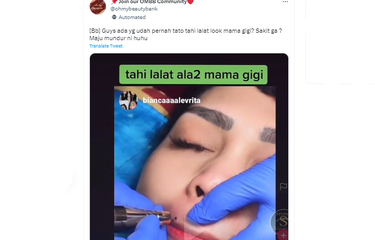 Marak Tren Bikin Tahi Lalat ala Nagita Slavina, Adakah Bahayanya ...