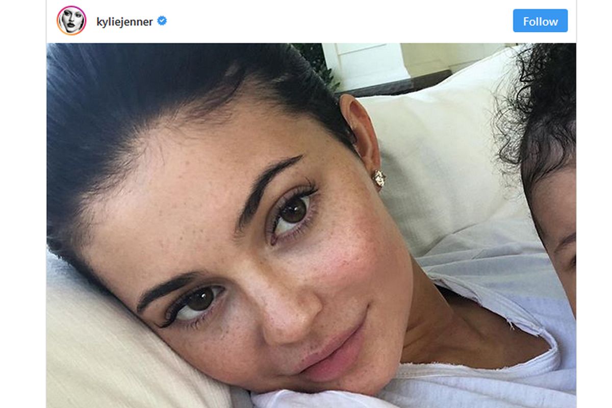 Kylie Jenner mengunggah foto tanpa makeup di akun tersebut, sambil memperlihatkan sedikit bagian dahi Stormi.