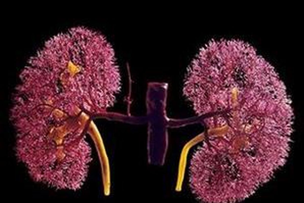 Ginjal salah satu organ paling penting dalam tubuh.